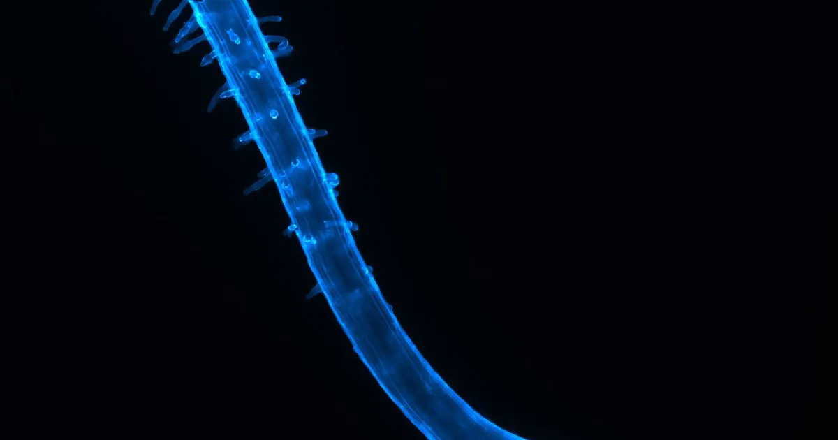 Rễ cây Arabidopsis chụp kính hiển vi huỳnh quang, thấy rõ lông hút và chóp rễ