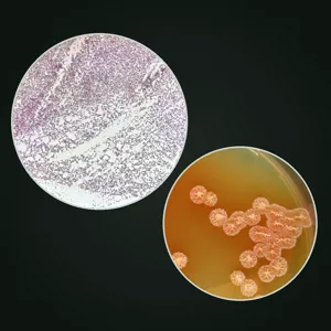 Vi khuẩn Bacillus subtilis dưới kính hiển vi và khuẩn lạc xạ khuẩn Streptomyces trên đĩa thạch