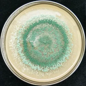Nấm Trichoderma phân lập từ đất, mọc thành vòng bào tử xanh trên đĩa thạch